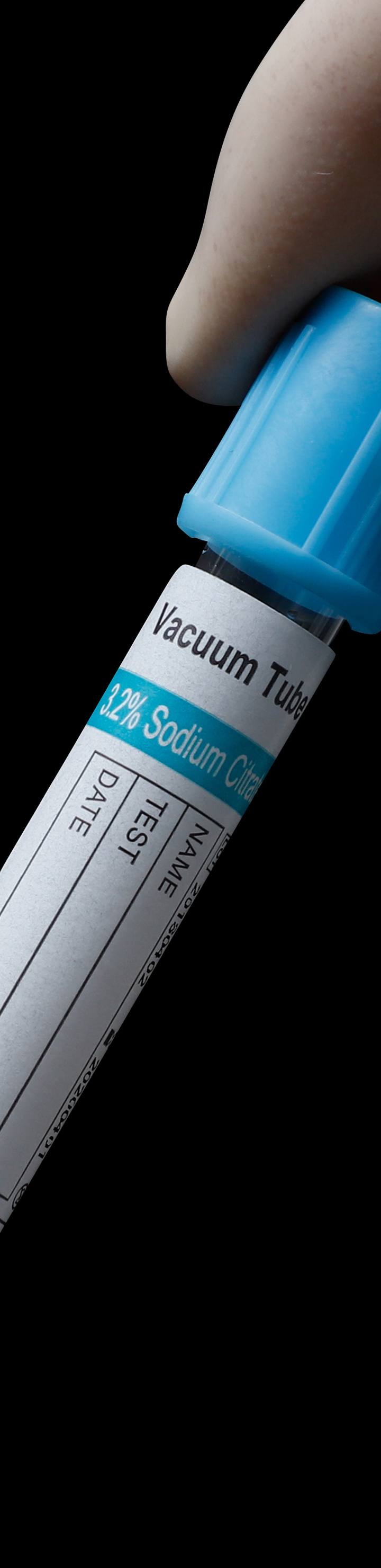 PT Tube Sodium Citrate1: 9 Vacuum Blood Collection Tube