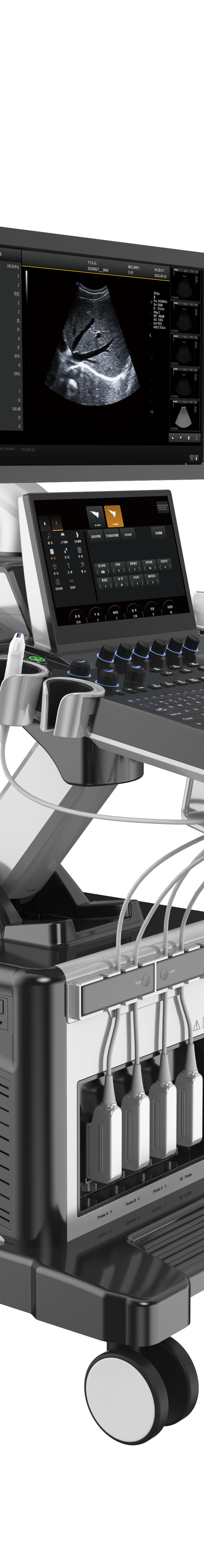 Ultrasound Machine Full Digital Ultrasonic Devices Ultrasound Diagnostic System T30