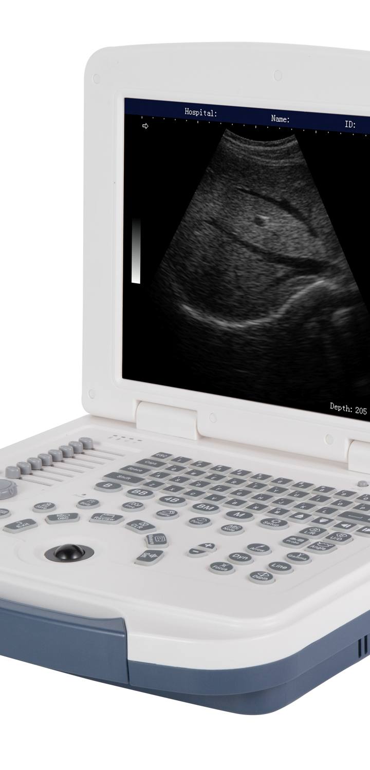 Ultrasound Machine Full Digital Ultrasonic Devices Ultrasound Diagnostic System